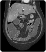 imaging_ct750_dose1