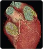 imaging_ct750_dose2