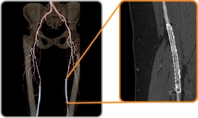 imaging_ct750_dose3